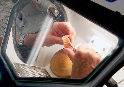 Denture Repair Burlington Fixing a Cracked Denture